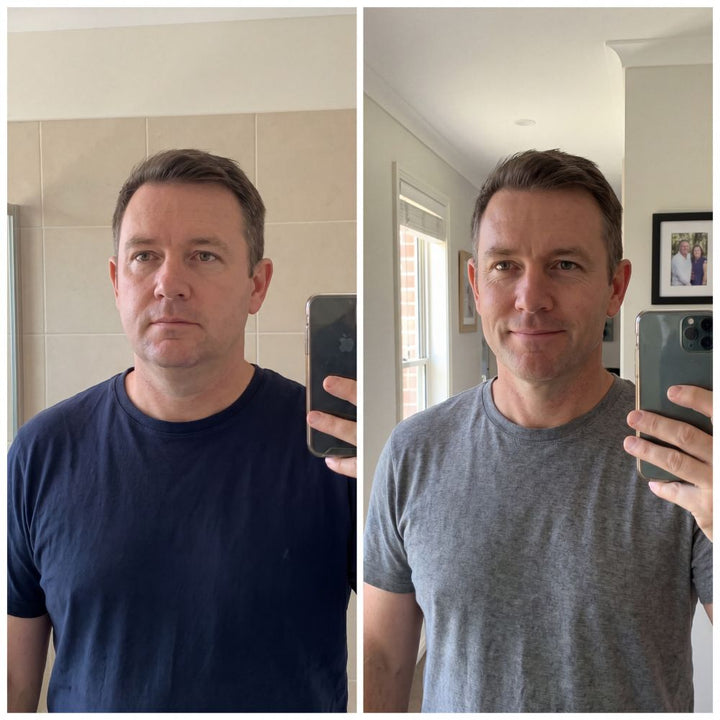 Antes y después de un cliente de Cara Dura