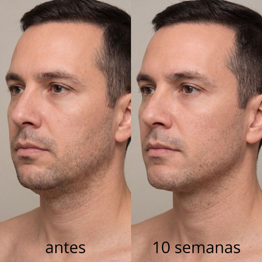 Banda Moldeadora de Colágeno Cara Dura™