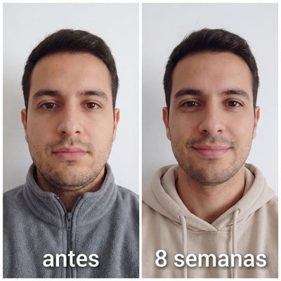 Banda Moldeadora de Colágeno Cara Dura™