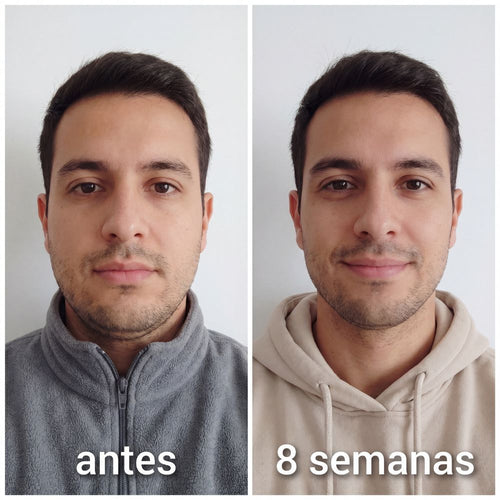 Banda Moldeadora de Colágeno Cara Dura