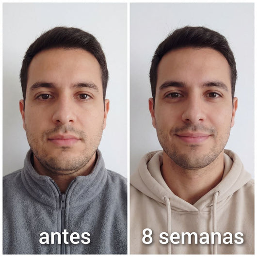 Banda Moldeadora de Colágeno Cara Dura™