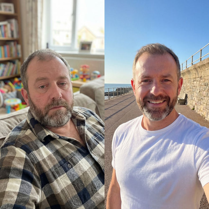 Antes y después de un cliente de Cara Dura
