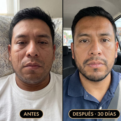 DESHINCHA™ | Gotas de Drenaje Linfático