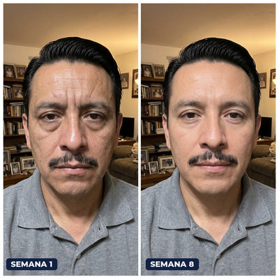 Antes y después con Firme Dura, semana 1 y semana 8
