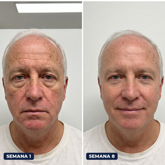 Antes y después con Firme Dura, semana 1 y semana 8