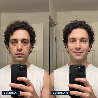 Antes y después con Firme Dura, semana 1 y semana 8