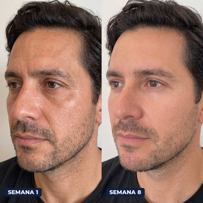 Antes y después con Firme Dura, semana 1 y semana 8