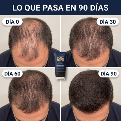 Coronilla en el día 0, 30, 60 y 90
