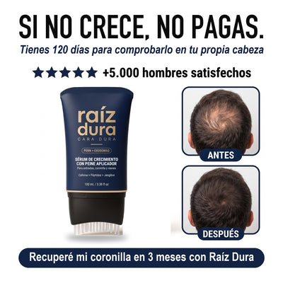 Si no crece, no pagas: 120 días para comprobarlo