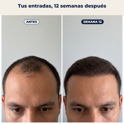 Entradas antes y 12 semanas después