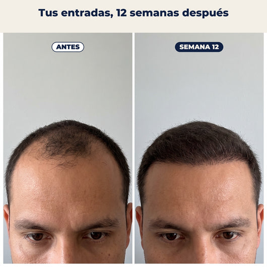 Entradas antes y 12 semanas después