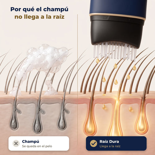 Raíz Dura: recupera tu pelo en entradas y coronilla